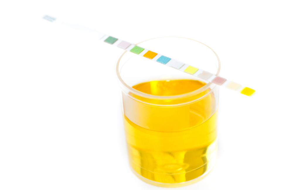 Decoding the Urine Color Chart: What Your Pee Says About Your Health"